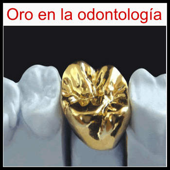 Oro en la odontología